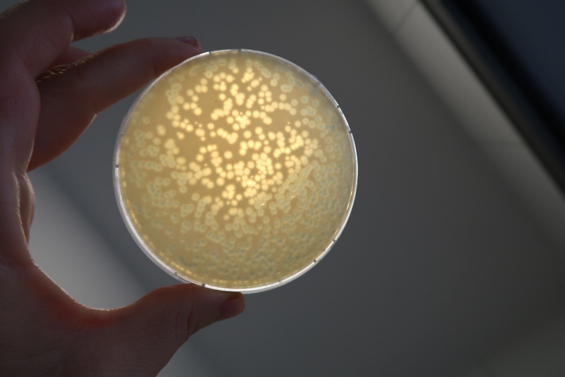 Plaque Assay Plaque Assay for measuring the concentration of test viruses